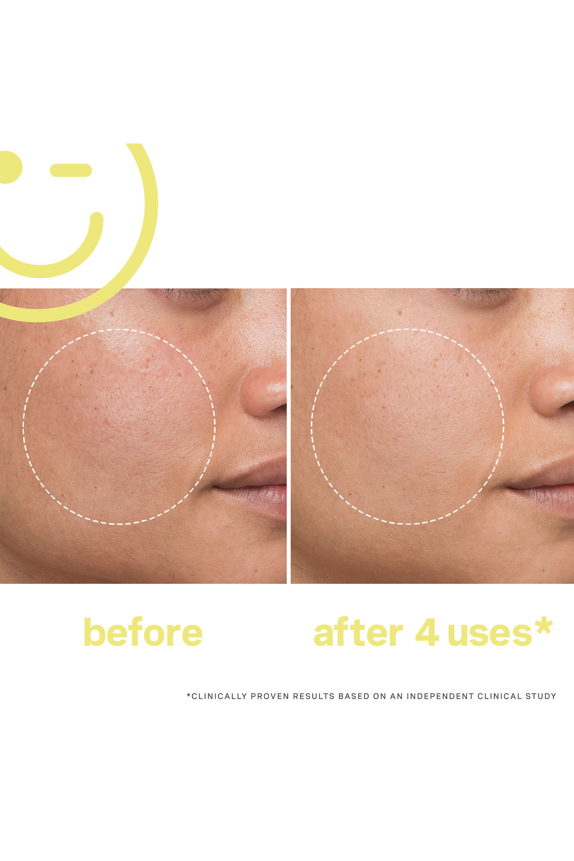 قناع فيشل ميغا-سي&trade; بفيتامين سي 30% لتفتيح البشرة