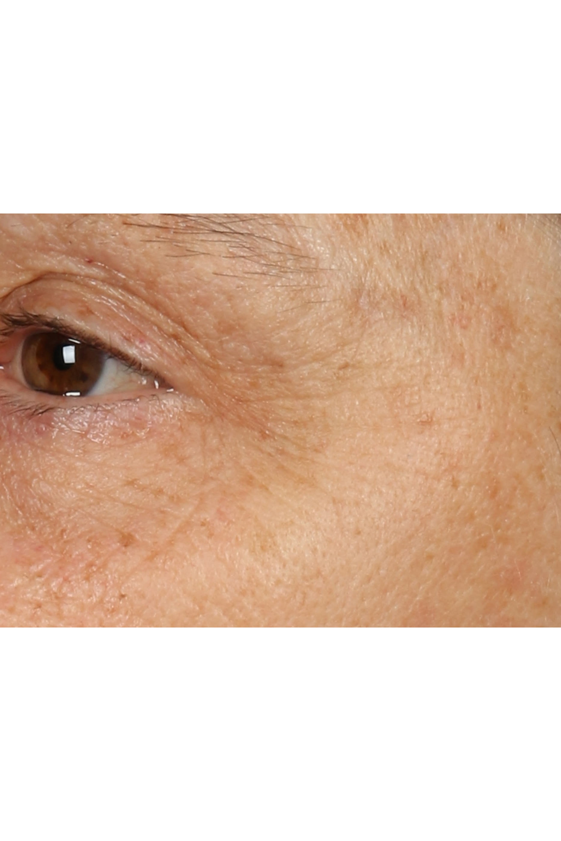 قناع + كريم سمارت كلينيكال ريبير ليلي لإصلاح البشرة