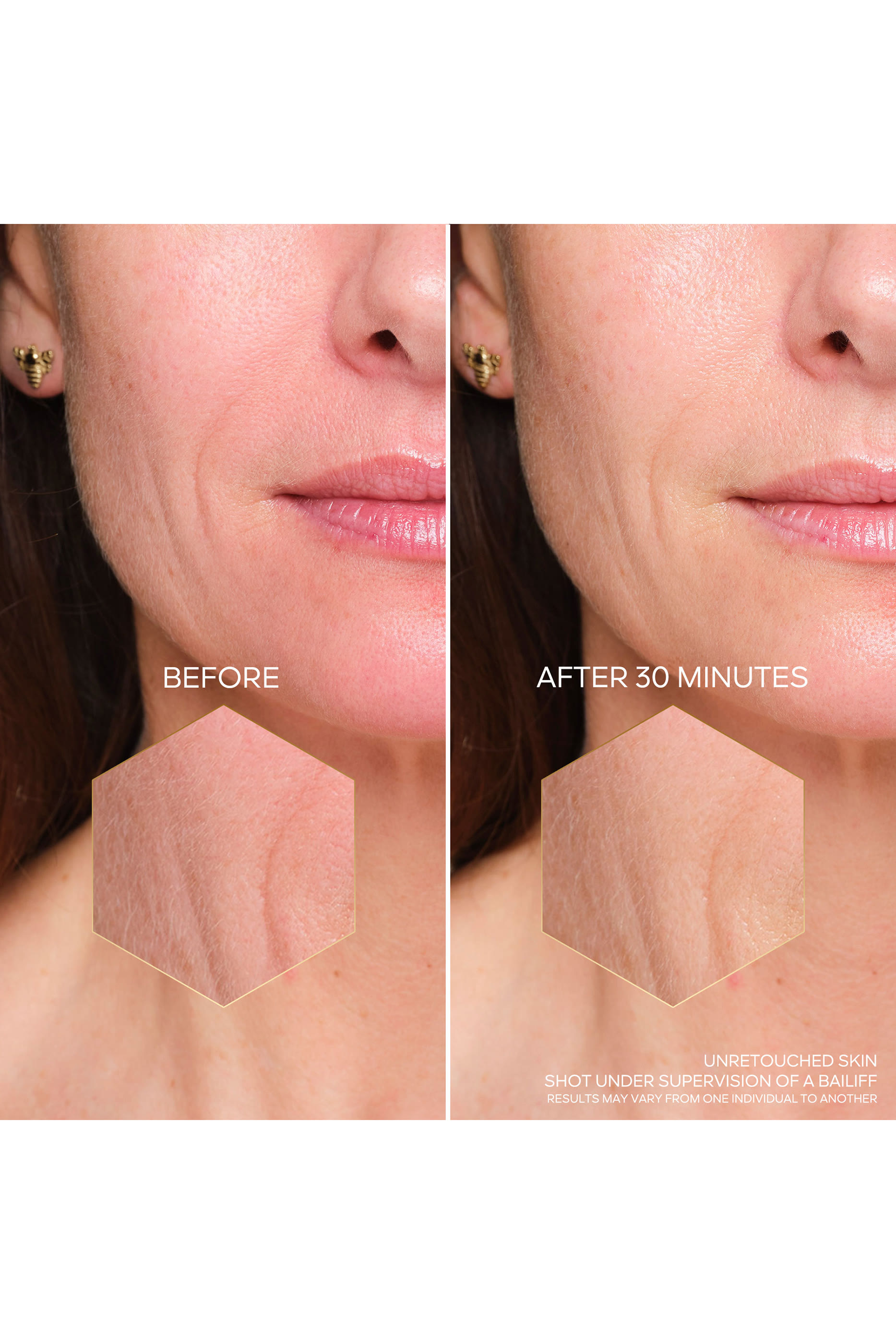 مجموعة أمبولات أباي رويال بي لاب وسيروم زيت مائي أباي رويال يوث